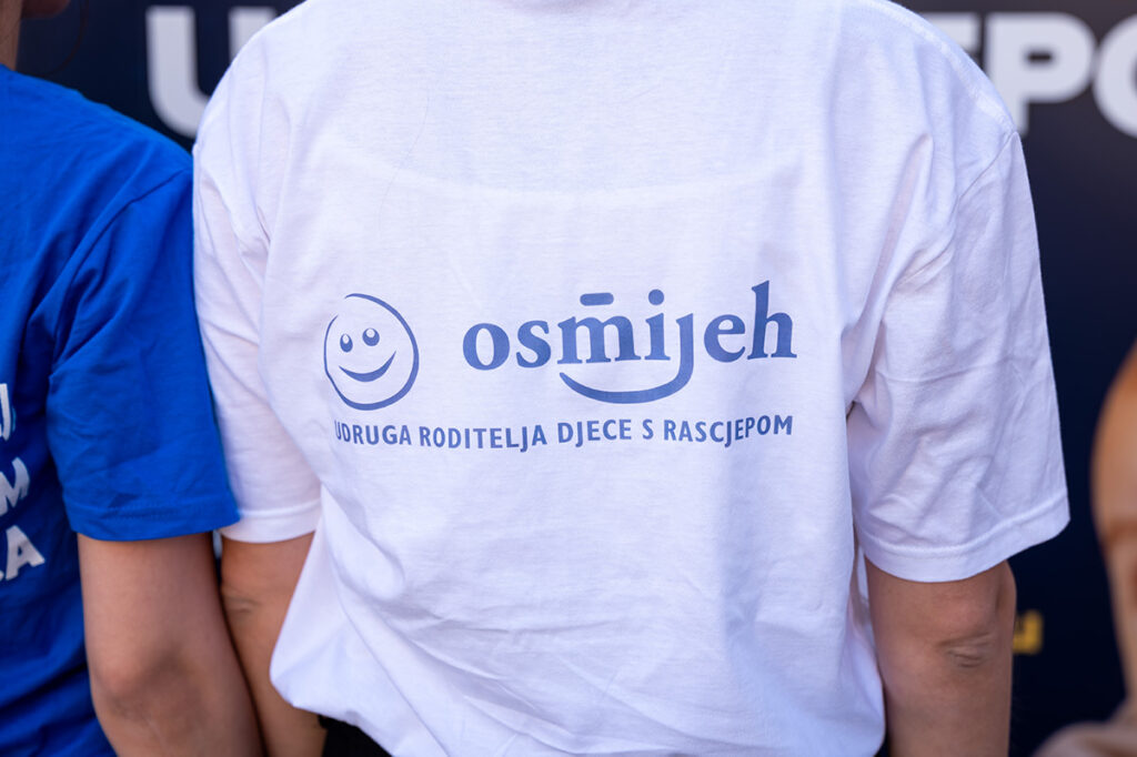 Tjedan svjesnosti - rascjep usne i/ili nepca kod djece